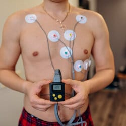 Electrocardiogram (ECG)